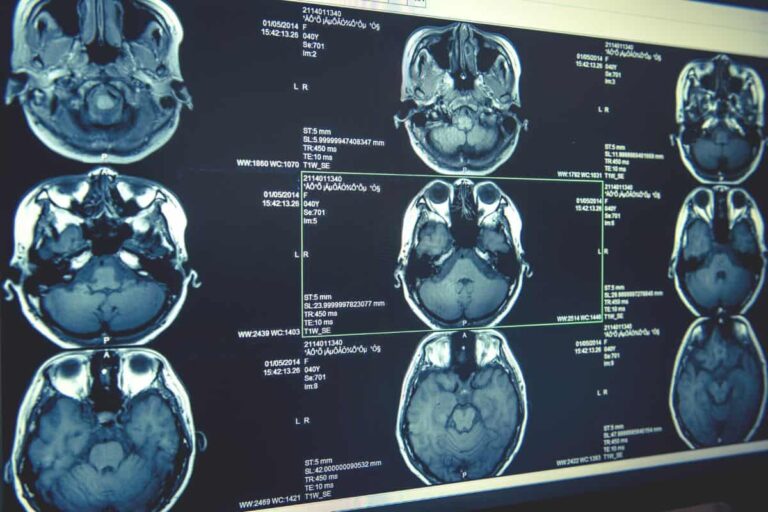 ct-scan-cost-in-malaysia-2024